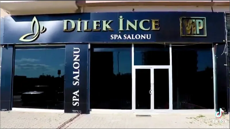 Malatya Masaj Dilek İnce vip — fotoğraf 2