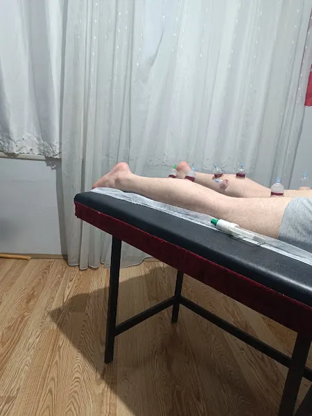Çivril Hacamat Sülük Tedavisi Doku ve Kas Masajı Manuel Terapi — fotoğraf 1